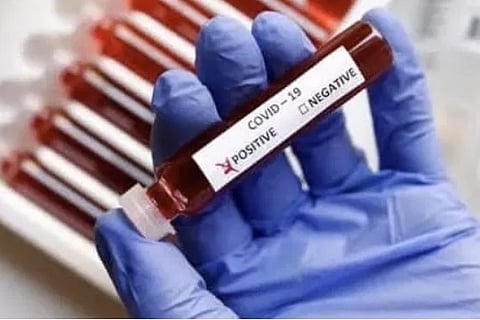 119 prisoners test corona positive in Jaipur district jail