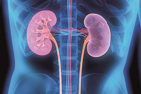 AI to predict acute kidney injury in Covid-19 patients