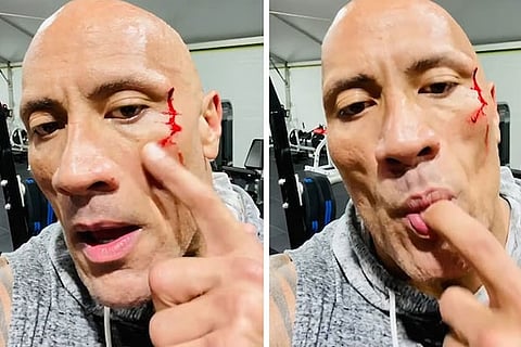 Dwayne Johnson injures face while working out