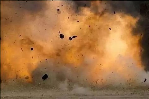 Representative Image