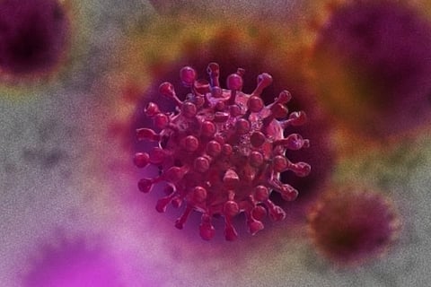 Representative Image