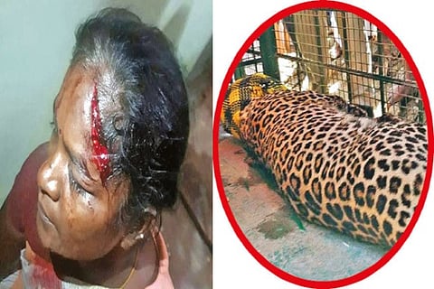 A deep gash in Prema?s head caused by the leopard; the tranquilised leopard