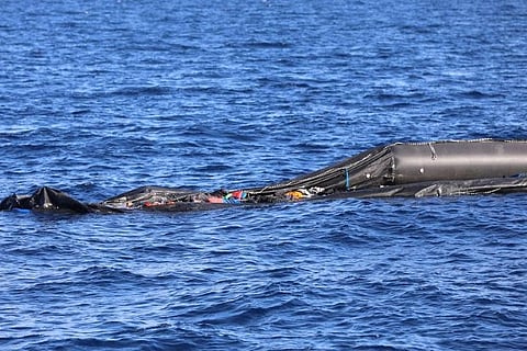 Representative Image