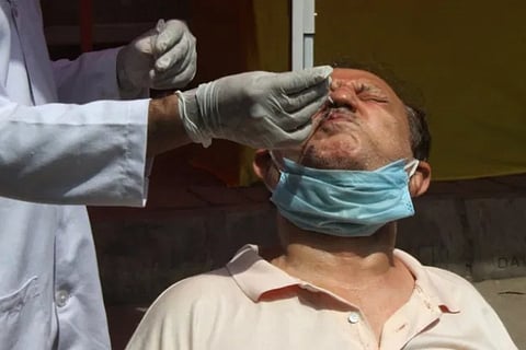 Probe ordered into 'goof up' in Covid test reports