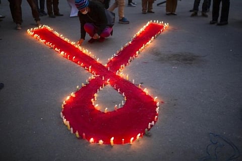 Representative image