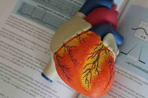 Representative image