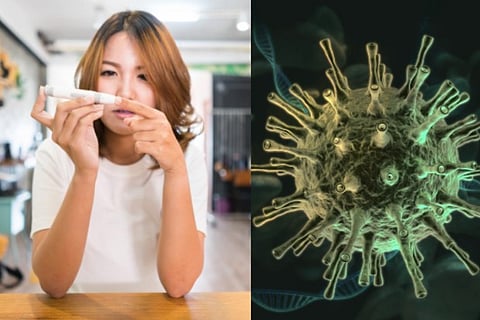 Representative image