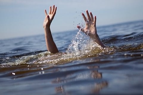 Representative image