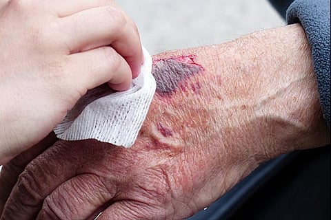 Representative image