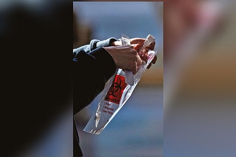 Representative image