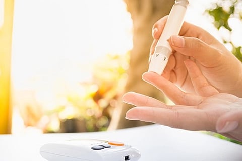 Representative image