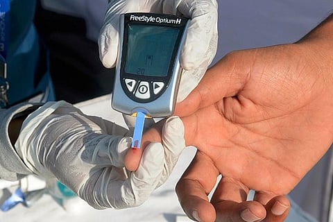 Representative image