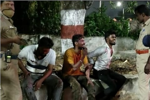 Police Nab Bike-borne Snatcher Trio After A Cinematic Chase Near Airport