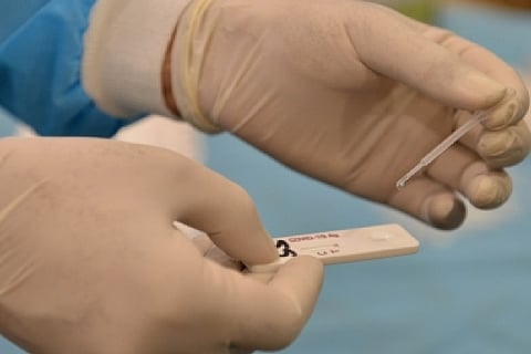 Representative Image