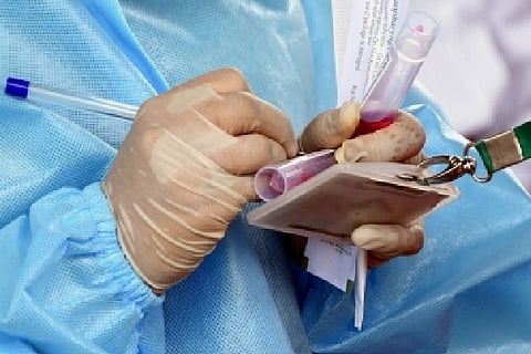 Representative Image