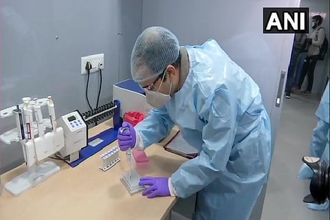 Representative Image (ANI)