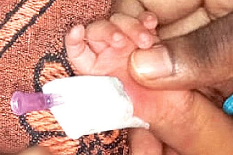 The baby recuperating