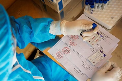 Representative Image