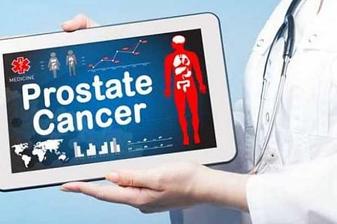 Early detection of prostate cancer a positive sign: Docs