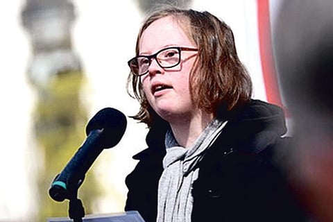 The case for prenatal Down Syndrome test