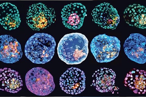 Pre-embryos made in lab to spur debates