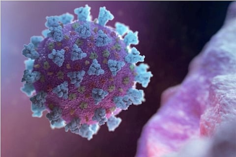 Representative Image