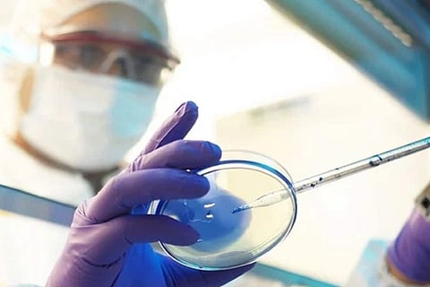 Representative Image