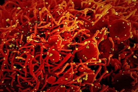 Representative image