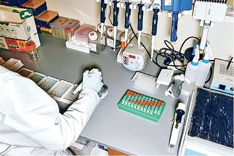 Representative Image