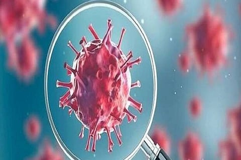 Representative Image