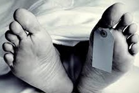 Representative image