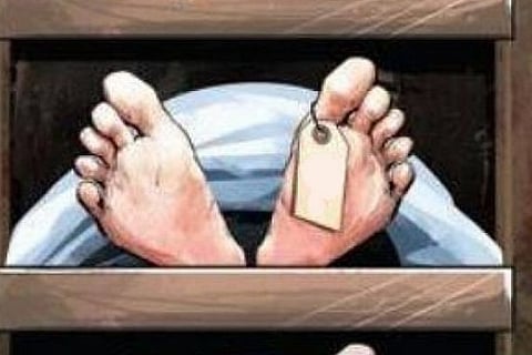 Representative image