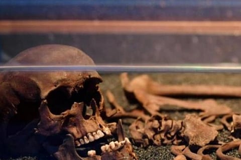 Representative image