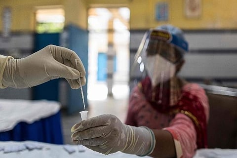 Representative Image