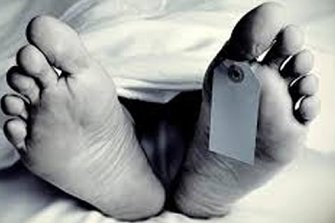 Representative Image