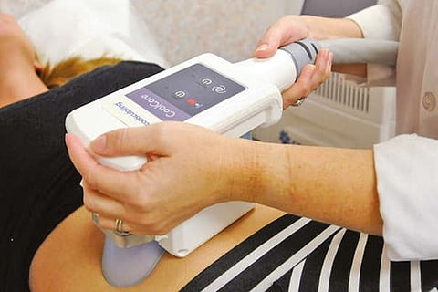 Cosmetic Conundrum: Nip and tuck - Digging into the origins of CoolSculpting