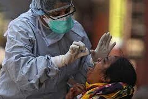 Representative Image