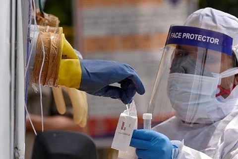 Representative Image