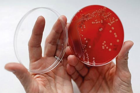 Scientists find how superbugs build their defences