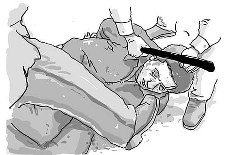 Representative Image