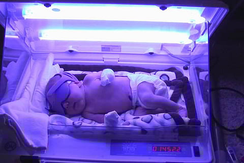 Representative image