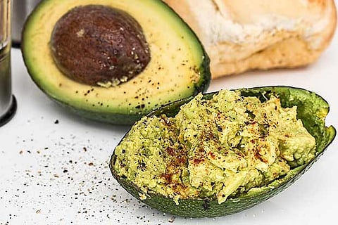 Representative Image