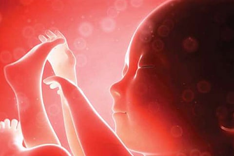 Representative Image