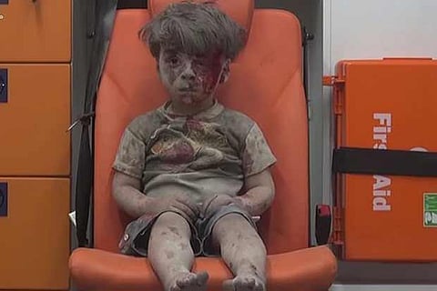 Omran Daqneesh, the 5-year-old boy saved from the rubble
