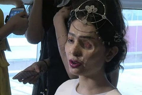 The runway appearance was part of FTL Moda's #TakeBeautyBack fashion week campaign