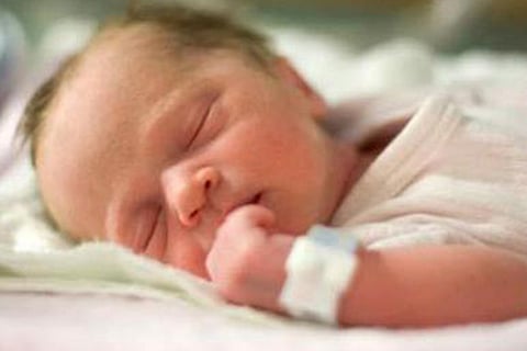 Representative Image