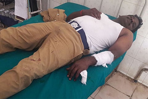 Constable Muthusamy admitted to Ottanchathiram General Hospital with injuries on his hand