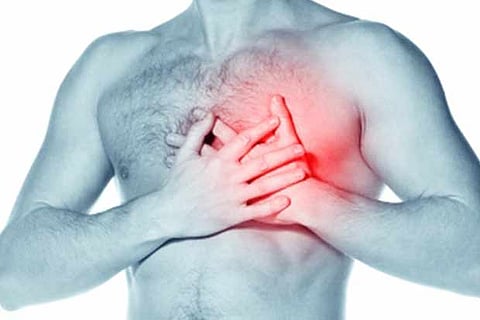 Representative Image