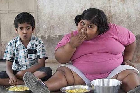 Representative Image