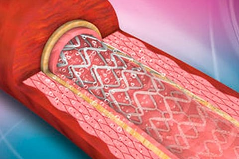 Photo for representative purpose only